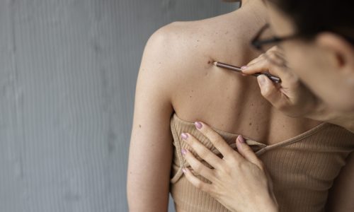 female-doctor-diagnosing-melanoma-body-female-patient